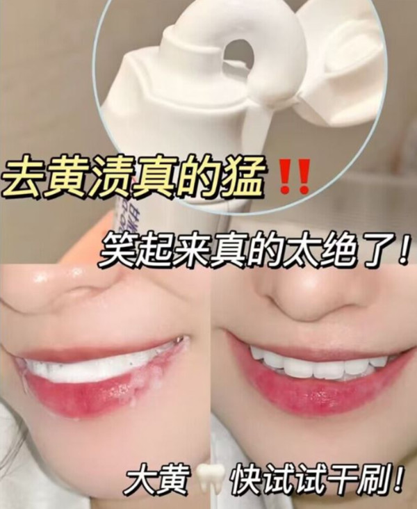 云南白药牙膏益生菌清洁口腔激爽薄荷4支套装官方正品t 图片 6