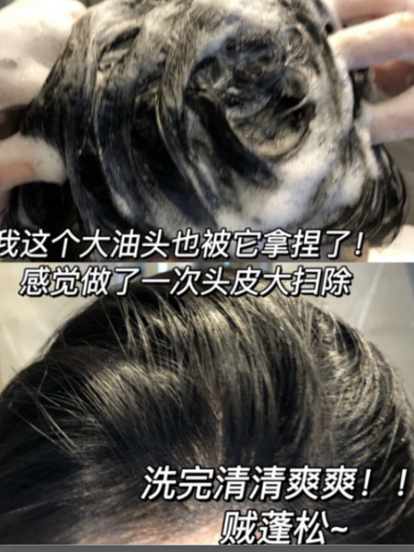 戴可思金盏花儿童洗发水3-6-12岁宝宝洗发露洗头膏女孩男童中大童 图片 5
