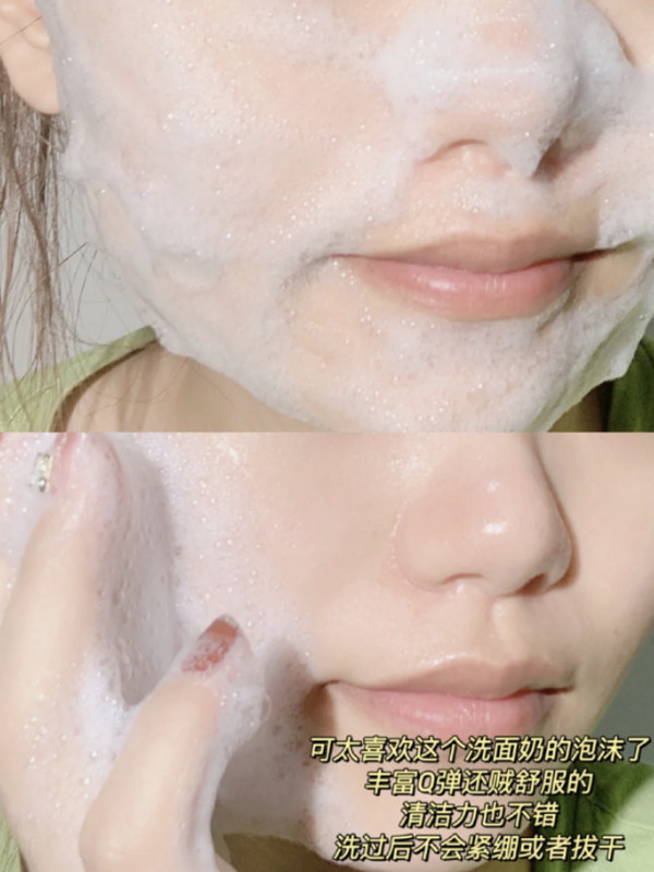 【专享】芙清医用洁面械字号清洁护理洁面乳洗面奶TK 图片 6