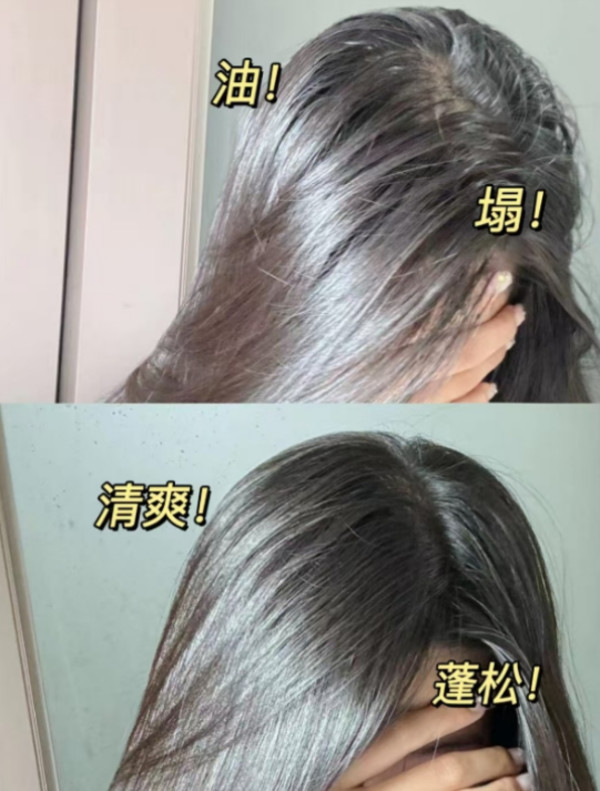 【天猫惊喜盒】滋源控油蓬松洗发水去屑止痒洗头膏保湿滋润沐浴露 图片 6