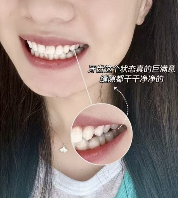 线报图片